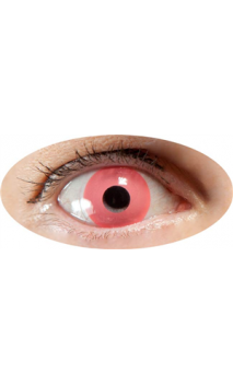 Lentilles Oeil Rose