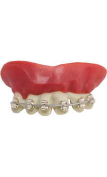 Dentier Appareil Dentaire