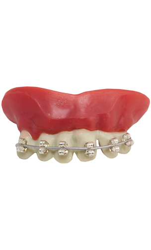 Dentier Appareil Dentaire