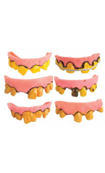 Dentier souple 
